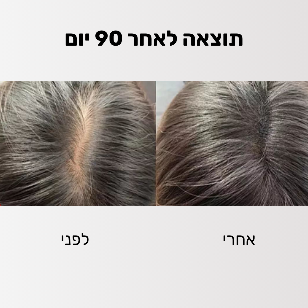 Glider - ערכה לטיפול ושיקום נשירת השיער