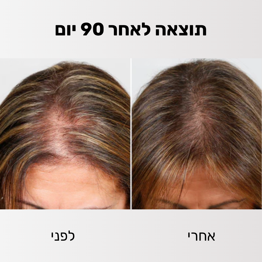 Glider - ערכה לטיפול ושיקום נשירת השיער