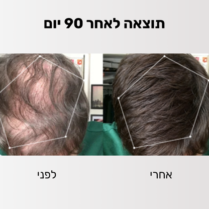 Glider - ערכה לטיפול ושיקום נשירת השיער