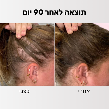 Glider - ערכה לטיפול ושיקום נשירת השיער