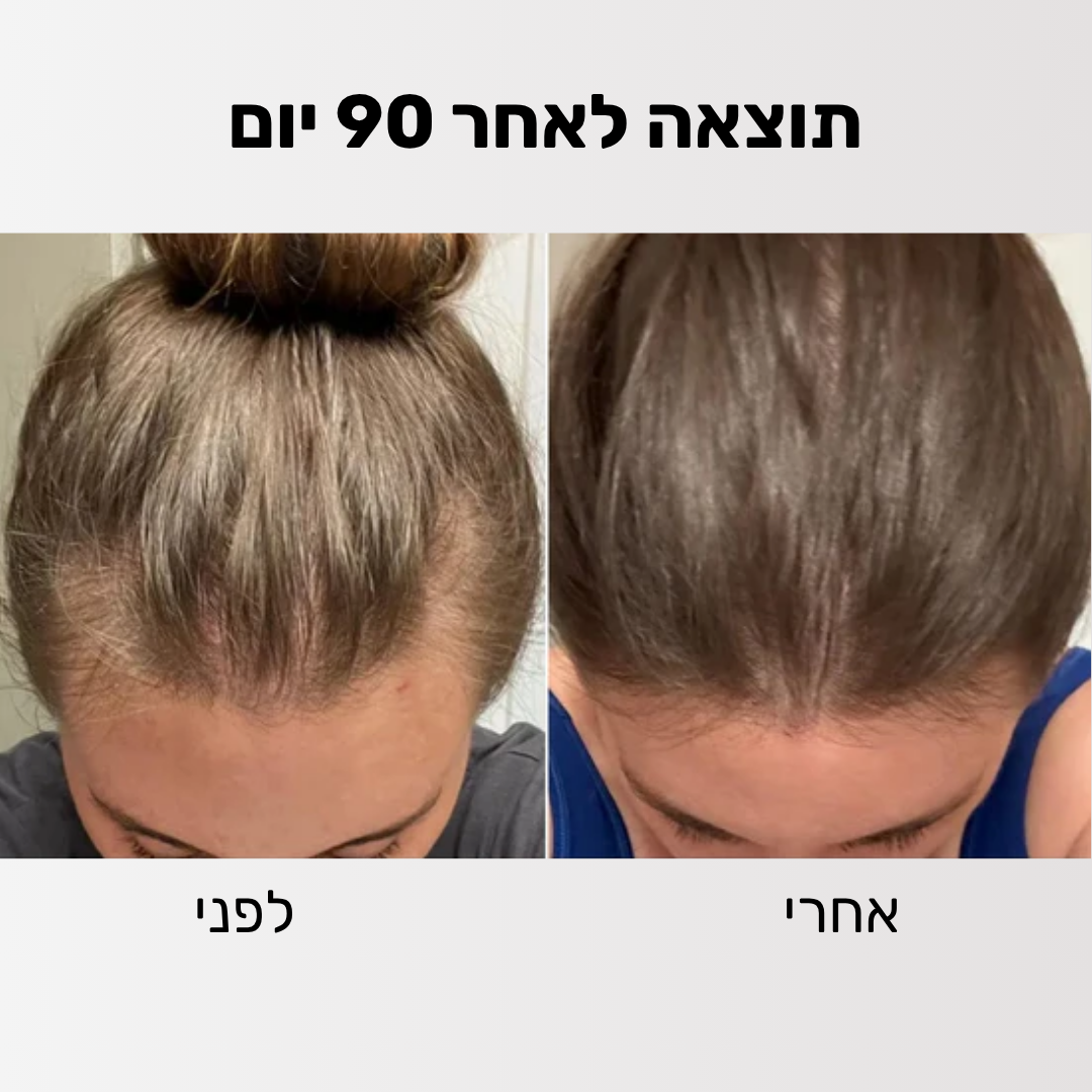 Glider - ערכה לטיפול ושיקום נשירת השיער