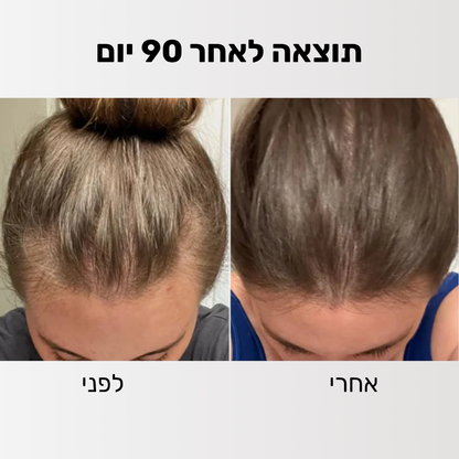 Glider - ערכה לטיפול ושיקום נשירת השיער