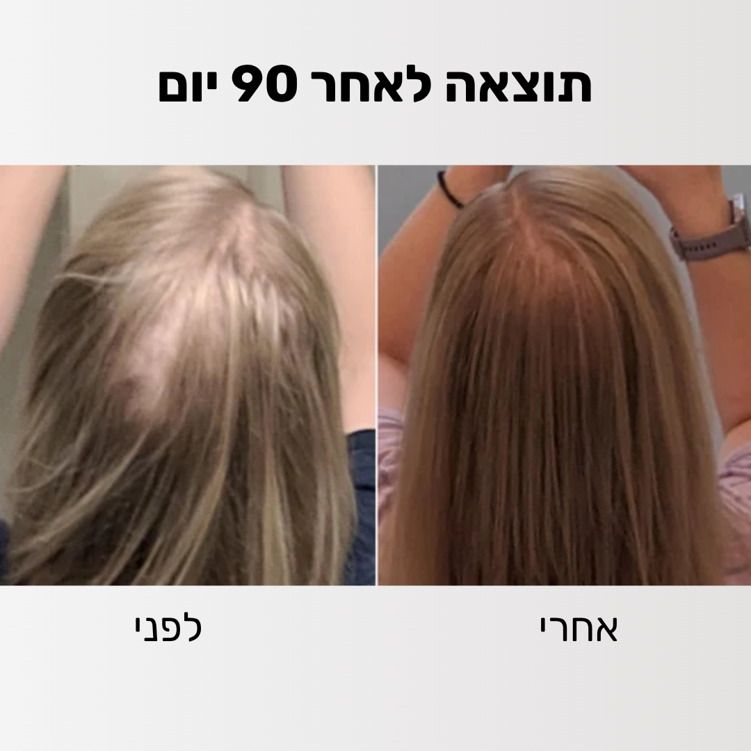 Glider - ערכה לטיפול ושיקום נשירת השיער