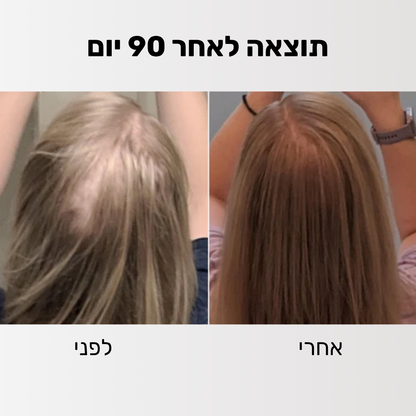Glider - ערכה לטיפול ושיקום נשירת השיער